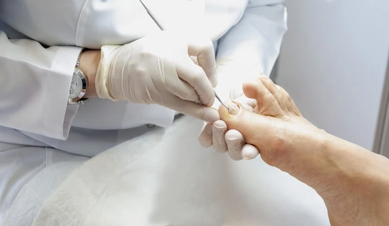 tırnak tedavisi batık tırnak düzeltme ve nasır bakımı evde profesyonel uygulama